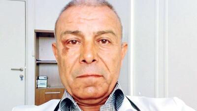 Skandal raporda ceza kesinleşti!