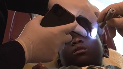 Üvey annesi asitle gözünü yaktı! Türk doktorlardan umutlandıran haber