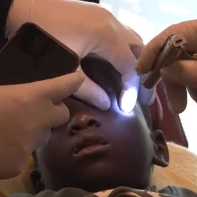 Üvey annesi asitle gözünü yaktı! Türk doktorlardan umutlandıran haber