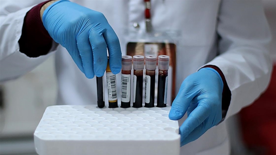 Donör akciğerlerin kan grubu evrensel kan grubuna dönüştürülebilir mi?