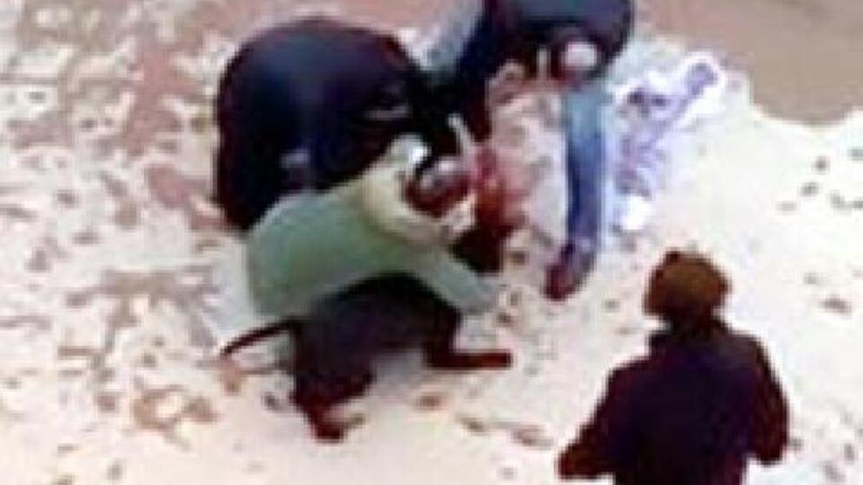 Minik Asiye'nin yaralanmasına ilişkin dava başladı!