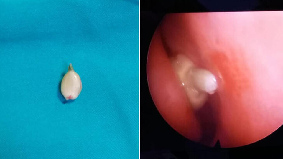 Sosyal medyada görüp burnuna yerleştirdi! Sonra da...