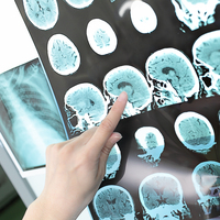 Koronavirüs geçirenlere kötü haber!