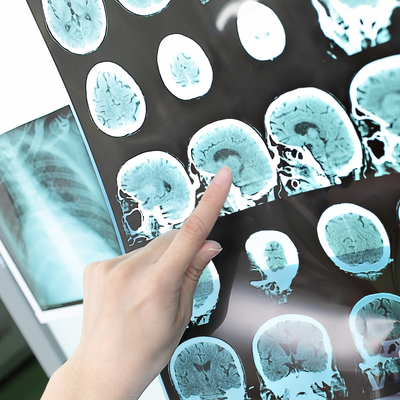 Koronavirüs geçirenlere kötü haber!