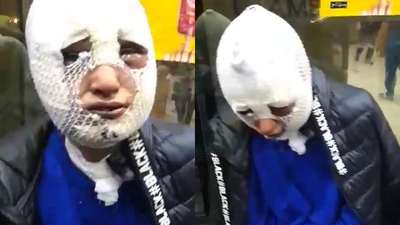 Sözlüsünün başına kızgın yağ döken adam yeniden tutuklandı