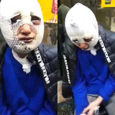 Sözlüsünün başına kızgın yağ döken adam yeniden tutuklandı