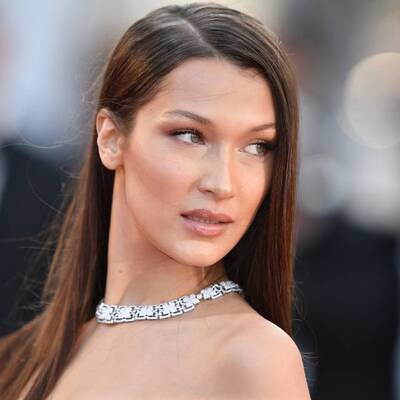 Estetik itirafı: 14 yaşındayken yaptırmıştım!