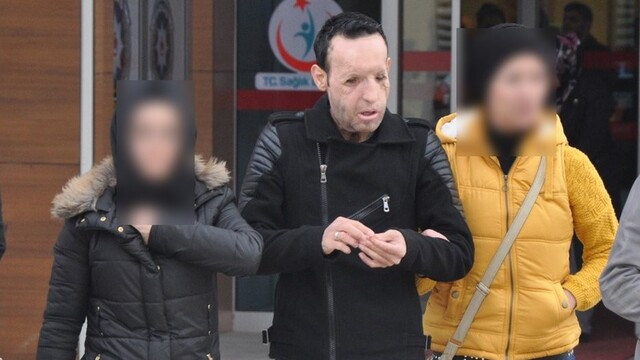 Yüz nakliyle tanınan Sert'e uyuşturucu gözaltısı
