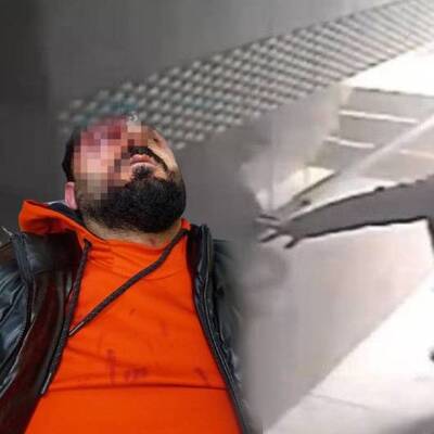 'Kime geldiniz?' dedi, kemikleri kırıldı!