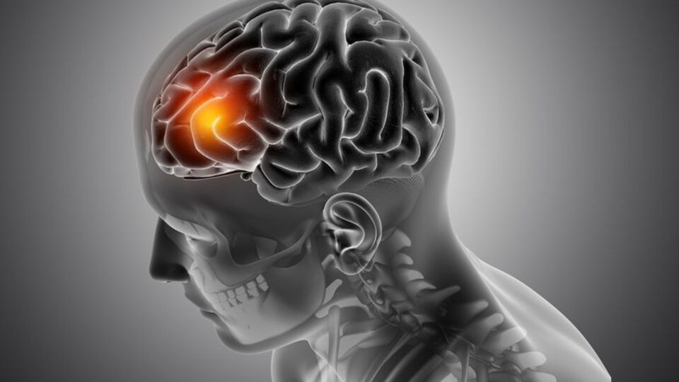 Epilepsiyle ilgili ön yargıları yıkma günü: Mor gün