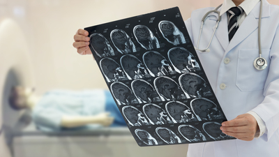 Nöbet geçiren kişiye soğan, sarımsak koklatmayın!