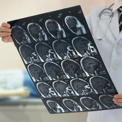 Nöbet geçiren kişiye soğan, sarımsak koklatmayın!