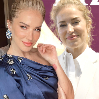 Burcu'nun yüzüne ne oldu?