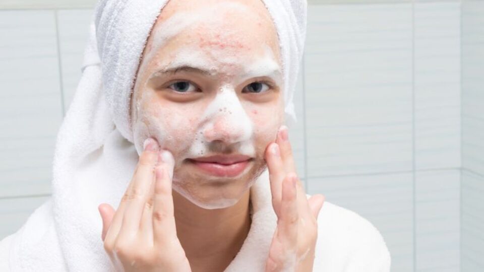 Akne izleri nasıl geçer?