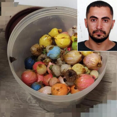 Otelde cansız bulundu! Bunlar öldürdü!