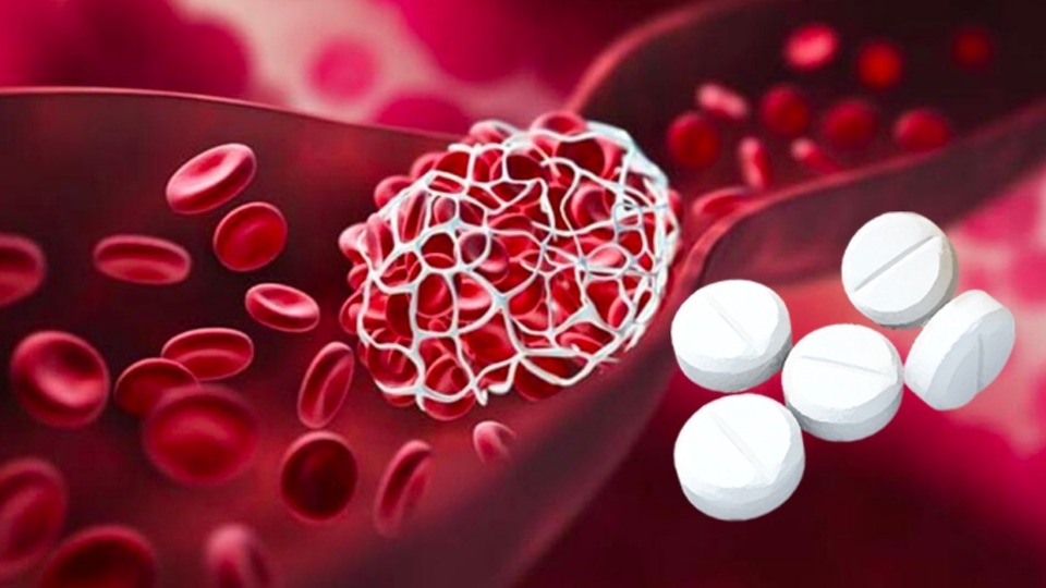 Kan sulandırıcılara dikkat! Kim kullanmalı kim kullanmamalı?