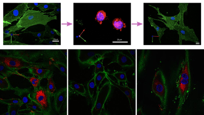 Devrim niteliğinde! Cilt hücrelerini 30 yıl gençleştirdiler