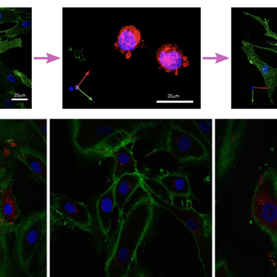 Devrim niteliğinde! Cilt hücrelerini 30 yıl gençleştirdiler