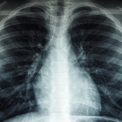 Havada 'mikroplastik' uyarısı!