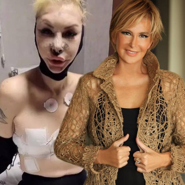 Filiz Akın'a benzemek için bıçak altına yattı