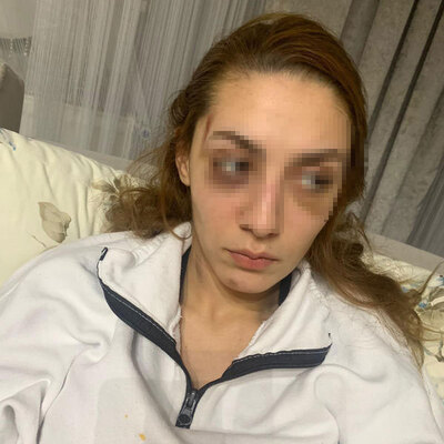 Dar eşofman ayrılığı! Barışalım dayağı!