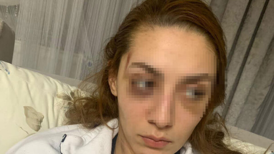 Dar eşofman ayrılığı! Barışalım dayağı!