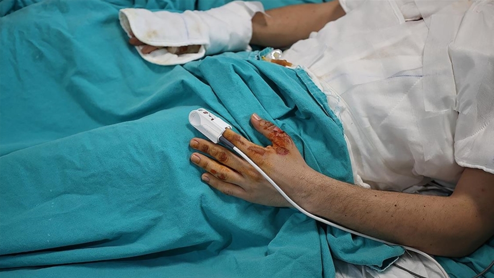 Evdeki anlık dikkatsizlik hasarı ömür boyu taşınabilecek ağır yanıklara yol açabiliyor