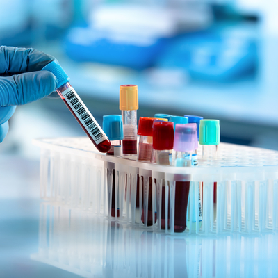 'Gizemli hepatit' virüsü bulaşan 8 çocuğa karaciğer nakli yapıldı