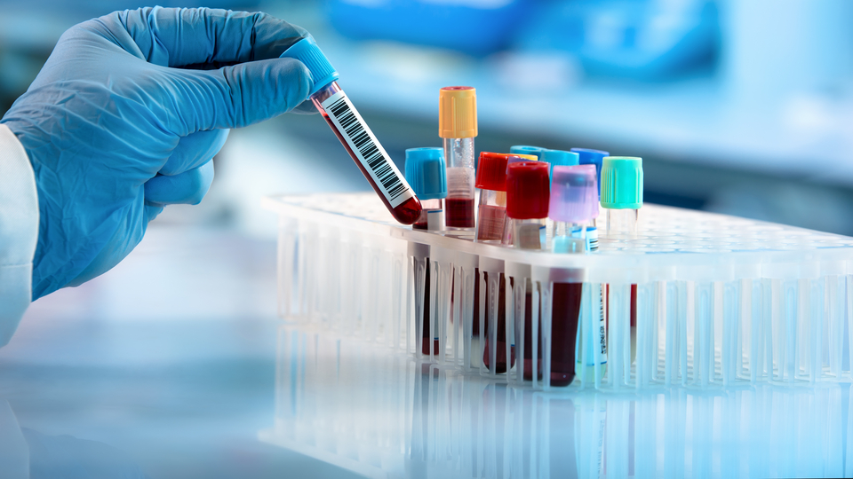 'Gizemli hepatit' virüsü bulaşan 8 çocuğa karaciğer nakli yapıldı