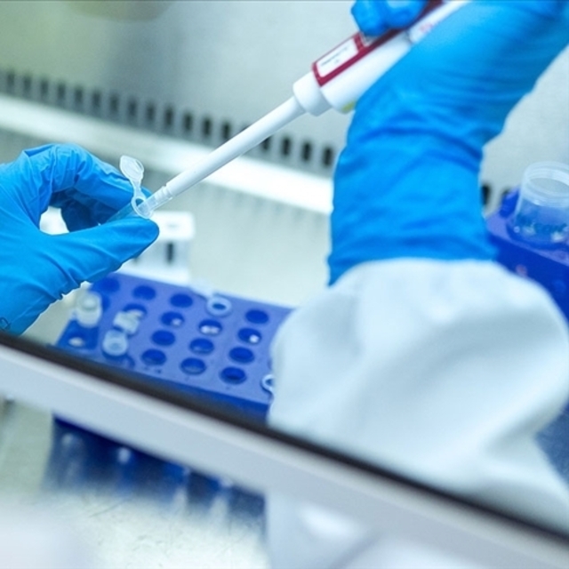 İsrail'de 12 çocukta gizemli hepatit vakası tespit edildi