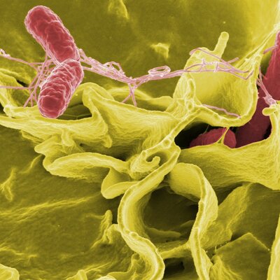 DSÖ açıkladı! 11 ülkede 151 Salmonella vakası