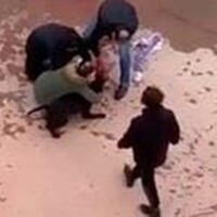Asiye'ye Pitbull saldırısı davasında sıcak gelişme!
