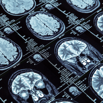 3 gün boyunca bu belirtilerle yaşadı! Hastaneye gitmeseydi...