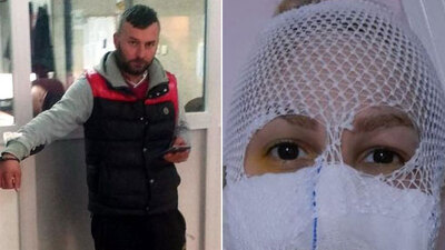 Sevgilisinin yüzüne kimyasal madde attı! Akılalmaz savunma!