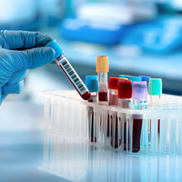 İngiltere'de maymun çiçeği virüsü vakaları 9'a yükseldi