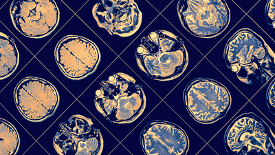 Artan hava kirliliği beyin sağlığını tehdit ediyor