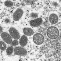 Maymun çiçeği virüsü alarmı! Yayılıyor