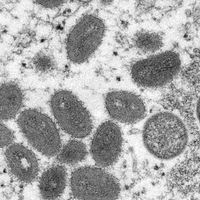 "Artık dünya virüslerin arka bahçesi"