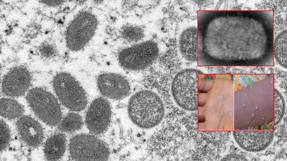 "Artık dünya virüslerin arka bahçesi"