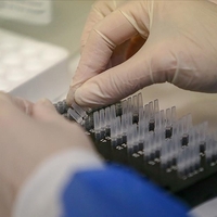 Belçika'da ilk maymun çiçeği virüsü vakası görüldü