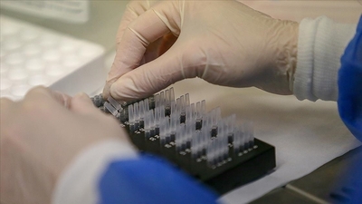 Belçika'da ilk maymun çiçeği virüsü vakası görüldü