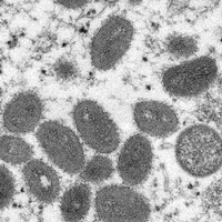 Maymun çiçeği virüsü nedir?