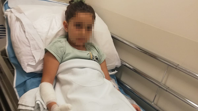 Feci iddia! Küçük kız MR'da yandı