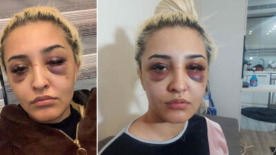 3 saat şiddet gören Gamze, şikayetini geri çekti