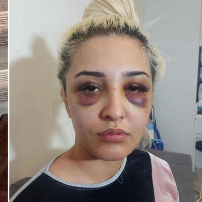 3 saat şiddet gören Gamze, şikayetini geri çekti