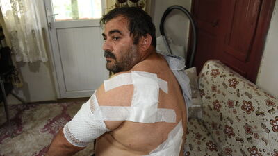 Ayı saldırısına uğradı! 65 dikiş atıldı