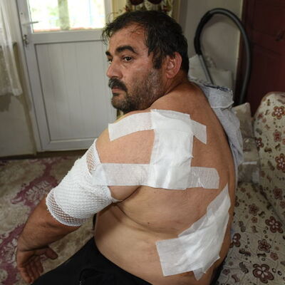 Ayı saldırısına uğradı! 65 dikiş atıldı