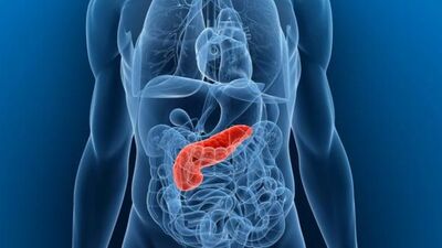 Pankreas kanseri iyileşme belirtileri