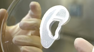 Devrim niteliğinde! 3D yazıcıyla üretilen kulak...