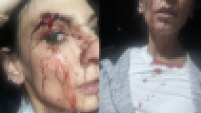 İstanbul'da bir sitede yaşandı! Genç kadını dövdüler